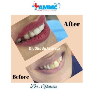 before and after - al magd 1