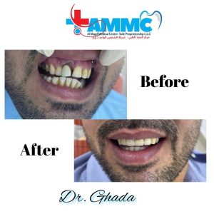 before and after - al magd 2
