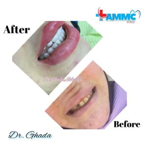 before and after - al magd 3