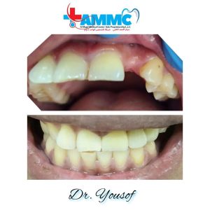 before and after - al magd