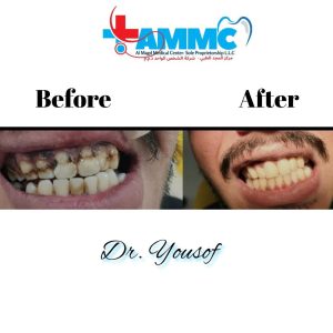 before and after - al magd 4