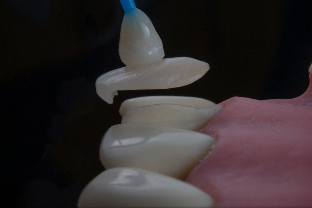 dental crown in al ain